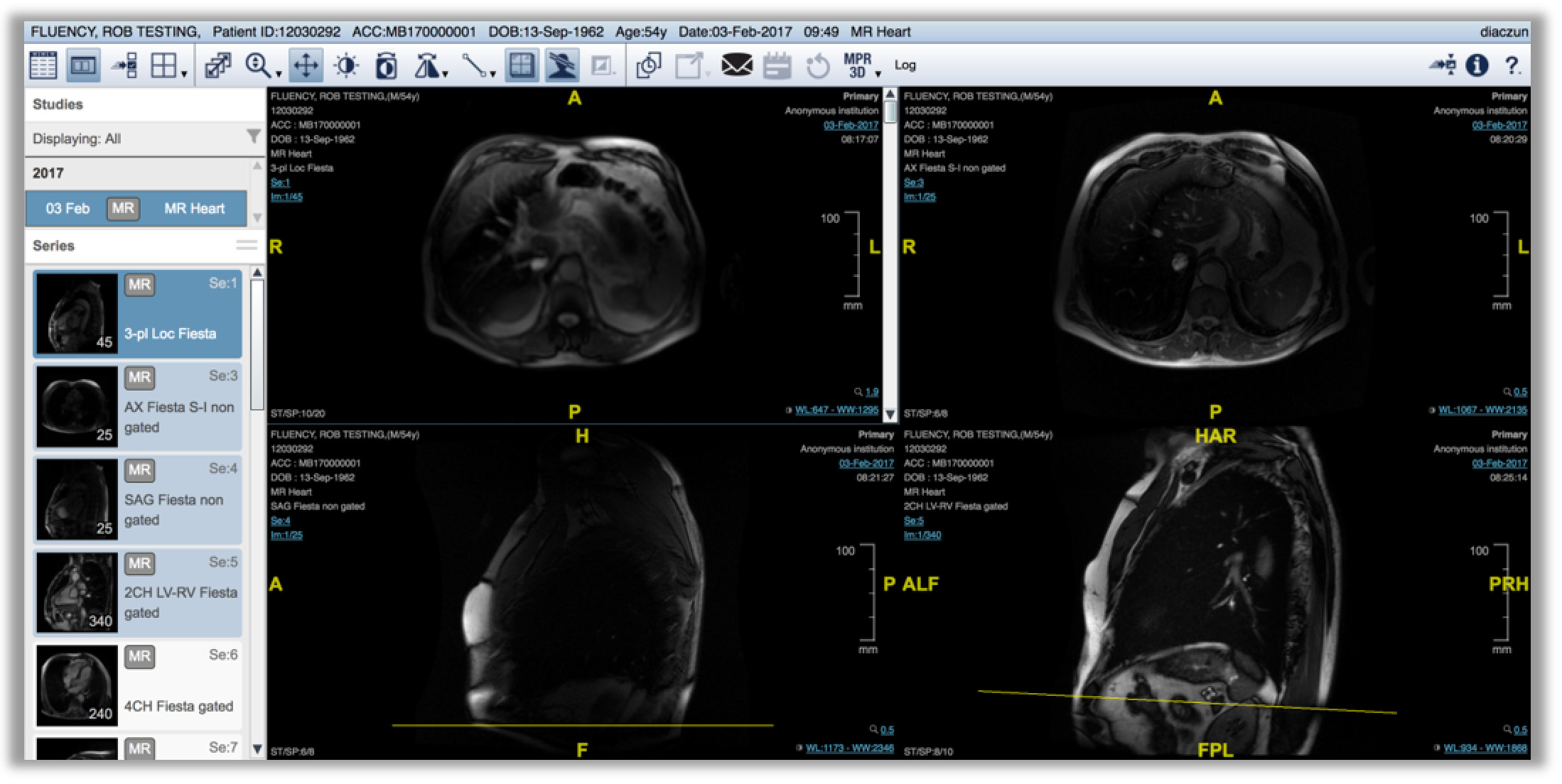 a radiology image